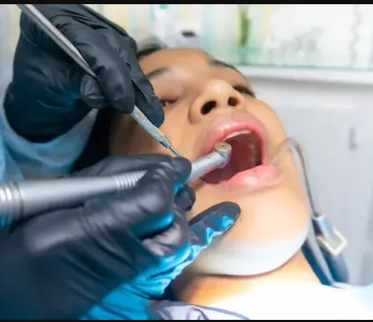 Ultrasonic Scaling & Polishing